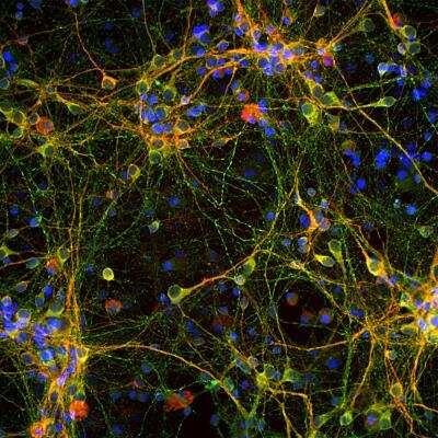 Immunocytochemistry/ Immunofluorescence: Tau Antibody [NBP2-25163]