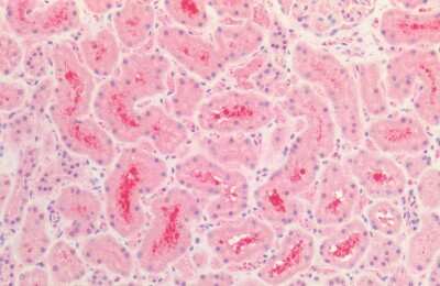 Immunohistochemistry: Tau Antibody [NBP3-18237]