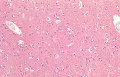 Immunohistochemistry: Tau Antibody [NBP3-18238]