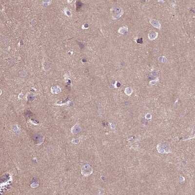 Immunohistochemistry-Paraffin: Tau Antibody [NBP2-49607]