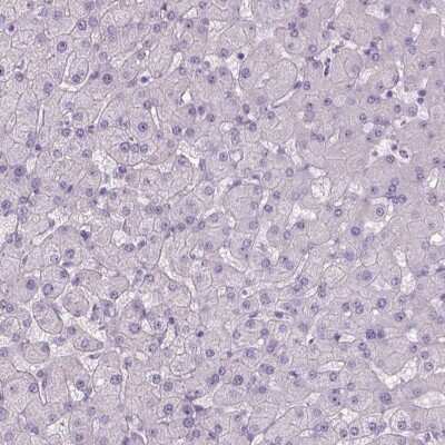 Immunohistochemistry-Paraffin: Tau Antibody [NBP2-49607]