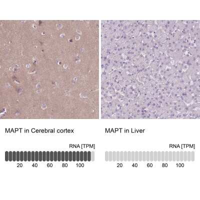 Immunohistochemistry-Paraffin: Tau Antibody [NBP2-49607]