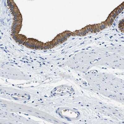 Immunohistochemistry-Paraffin: TauT/SLC6A6 Antibody [NBP1-86964]
