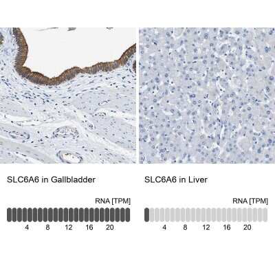 Immunohistochemistry-Paraffin: TauT/SLC6A6 Antibody [NBP1-86964]