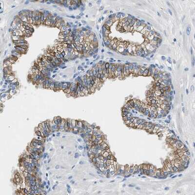 Immunohistochemistry-Paraffin: TauT/SLC6A6 Antibody [NBP1-86964]