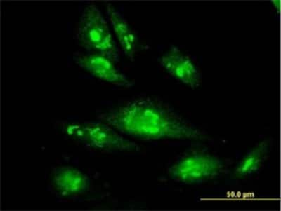 Immunocytochemistry/ Immunofluorescence: Tbp7 Antibody (3G8) [H00005704-M01]