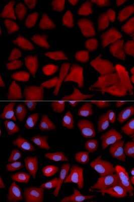 Immunocytochemistry/ Immunofluorescence: Tbp7 Antibody - BSA Free [NBP2-93919]