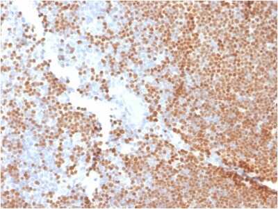 Immunohistochemistry-Paraffin: TdT Antibody (DNTT/1453) - Azide and BSA Free [NBP3-08563]