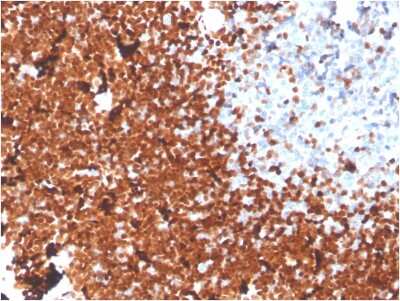 Immunohistochemistry-Paraffin: TdT Antibody (DNTT/1453) - Azide and BSA Free [NBP3-08563]