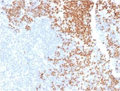 Immunohistochemistry-Paraffin: TdT Antibody (DNTT/1453) [NBP3-07683]
