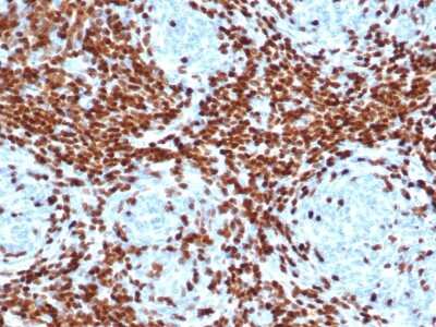 Immunohistochemistry-Paraffin: TdT Antibody (DNTT/4506R) [NBP3-07684]