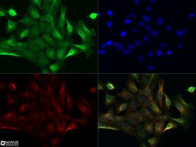 Immunocytochemistry/ Immunofluorescence: TdT Antibody [NBP2-31368]