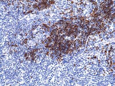 Immunohistochemistry: TdT Antibody (RM379) [NBP2-77436]