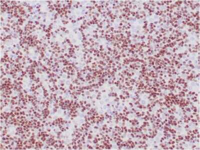 Immunohistochemistry-Paraffin: TdT Antibody (TDT/1393) [NBP3-07673]
