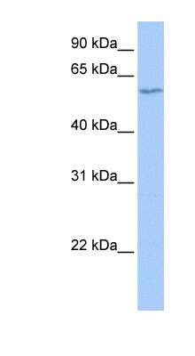 Western Blot: TdT Antibody [NBP1-58254]