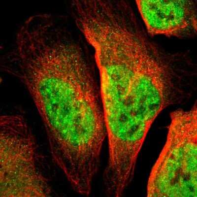 Immunocytochemistry/ Immunofluorescence: Teashirt homolog 1 Antibody [NBP1-87377]