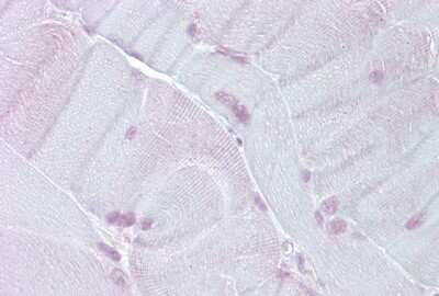 Immunohistochemistry: Tef Antibody [NBP2-84300]