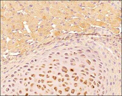 Immunohistochemistry-Paraffin: Tenascin C Antibody (4C8MS) - BSA Free [NB110-68136]