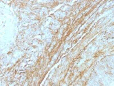 Immunohistochemistry-Paraffin: Tenascin C Antibody (T2H5) [NBP2-44582]