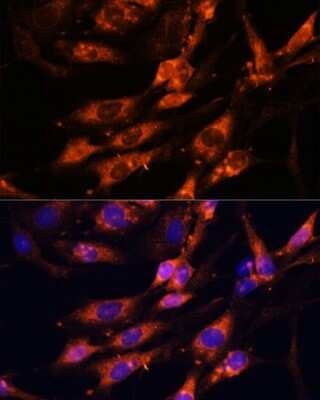 Immunocytochemistry/ Immunofluorescence: Teneurin-1 Antibody - Azide and BSA Free [NBP2-93336]