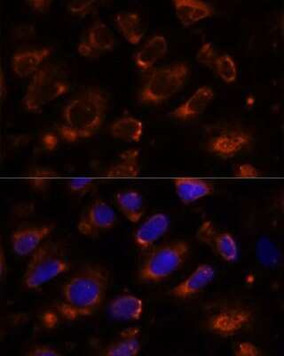 Immunocytochemistry/ Immunofluorescence: Teneurin-1 Antibody - Azide and BSA Free [NBP2-93336]