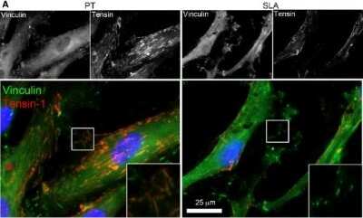 Immunocytochemistry/ Immunofluorescence: Tensin 1 Antibody [NBP1-84129]