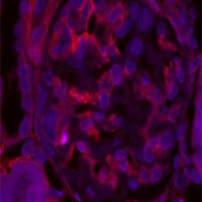 Immunohistochemistry-Paraffin: Tensin 1 Antibody [NBP1-84129]