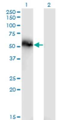 Western Blot: Tensin 4/CTEN Antibody (3B8) [H00084951-M01]