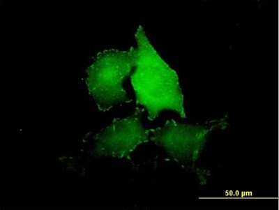 Immunocytochemistry/ Immunofluorescence: Tensin 4/CTEN Antibody [H00084951-B01P]