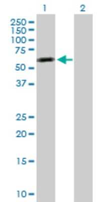Western Blot: Tensin 4/CTEN Antibody [H00084951-D01P]