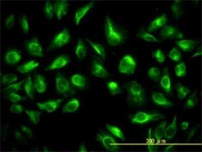 Immunocytochemistry/ Immunofluorescence: Testin Antibody (1G11-B7) [H00026136-M01]