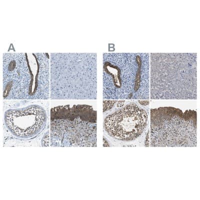 Immunohistochemistry-Paraffin: Testin Antibody [NBP1-87987]