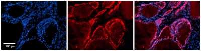 Immunohistochemistry-Paraffin: Testin Antibody [NBP2-88429]