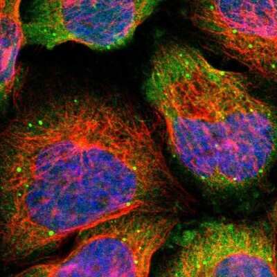 Immunocytochemistry/ Immunofluorescence: Testis Development Related Protein Antibody [NBP1-93675]