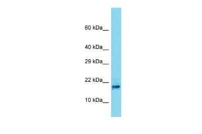 Western Blot: Testis Development Related Protein Antibody [NBP2-83577]