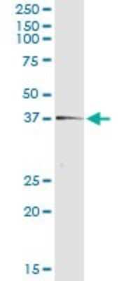 Immunoprecipitation: Testis expressed 264 Antibody (2A3-1A10) [H00051368-M01]