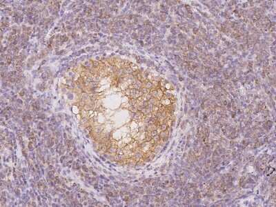 Immunohistochemistry-Paraffin: Testis expressed 264 Antibody [NBP2-98192]