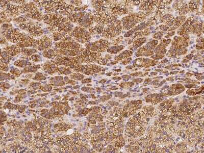 Immunohistochemistry-Paraffin: Testis expressed 264 Antibody [NBP2-98192]