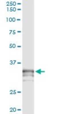 Immunoprecipitation: Testisin/Prss21 Antibody (2E10) [H00010942-M01]