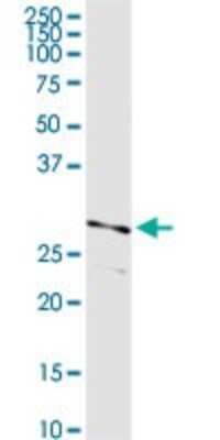 Western Blot: Testisin/Prss21 Antibody [H00010942-D01P]