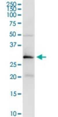 Western Blot: Testisin/Prss21 Antibody [H00010942-D01P]