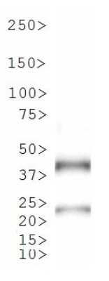 Western Blot: TetR AntibodyBSA Free [NB600-234]