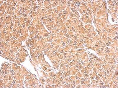 Immunohistochemistry-Paraffin: TSPAN3 Antibody [NBP2-20604]