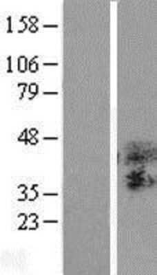 Western Blot: TSPAN3 Overexpression Lysate [NBP2-10446]