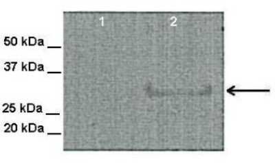 Western Blot: Tetraspanin-31 Antibody [NBP1-62311]
