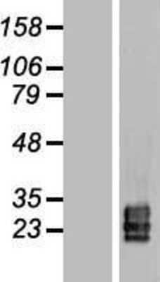 Western Blot: TSPAN9 Overexpression Lysate [NBL1-17383]