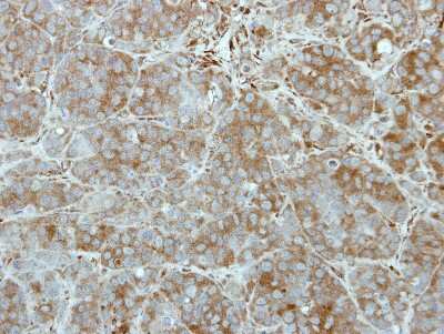 Immunohistochemistry-Paraffin: Tex14 Antibody [NBP2-20605]