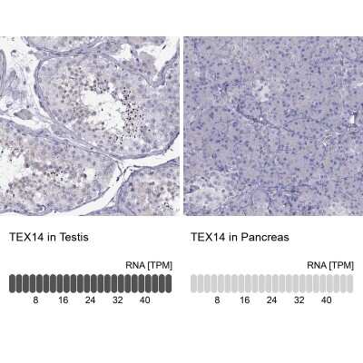Immunohistochemistry-Paraffin: Tex14 Antibody [NBP2-62709]