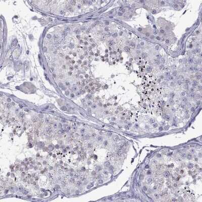 Immunohistochemistry-Paraffin: Tex14 Antibody [NBP2-62709]