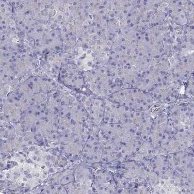 Immunohistochemistry-Paraffin: Tex14 Antibody [NBP2-62709]